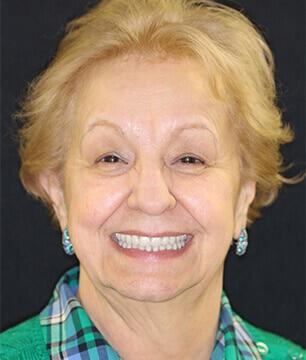 older woman after new dentures